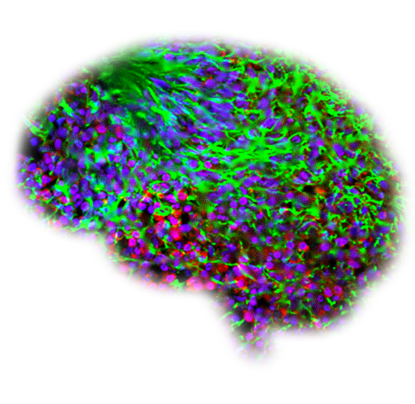 Organoid technology for personalized treatments